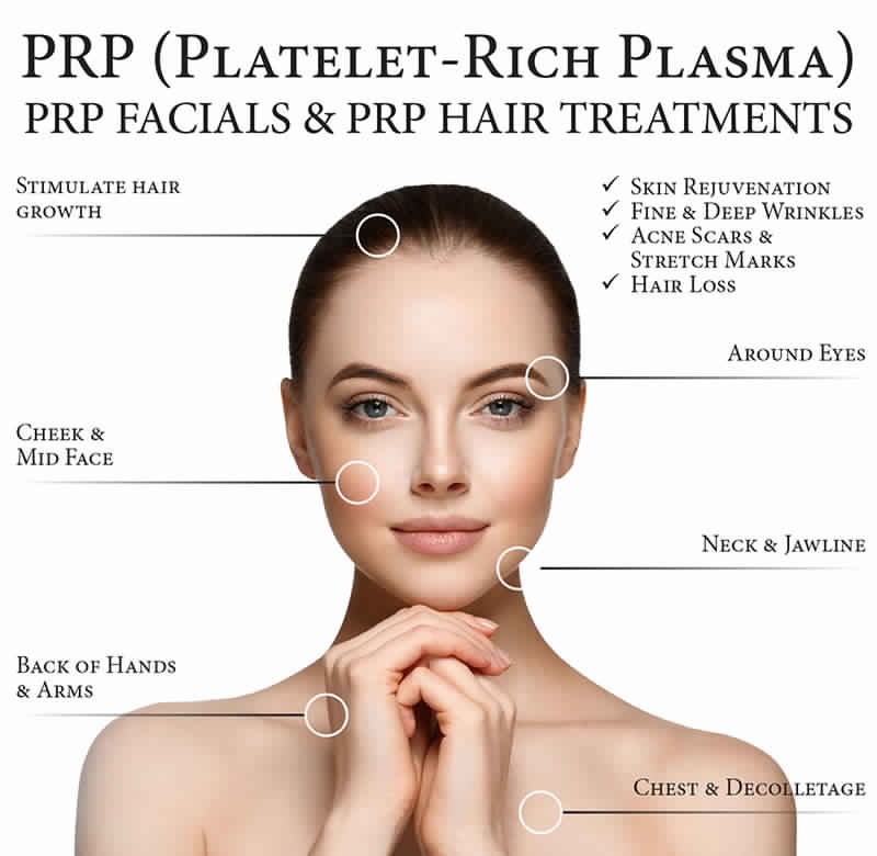 PRP Applications